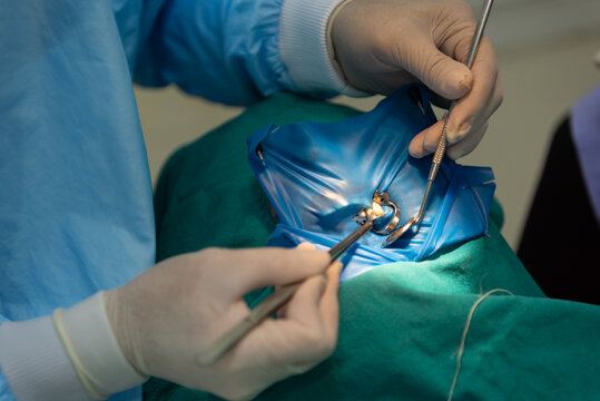 dentist performing tooth procedure with rubber dam isolation and instruments in sterile clinic closeup of hands tools and treated tooth in oral healthcare setting