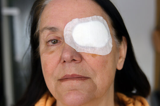 Frau tr&auml;gt eine Augenklappe nach einer Operation