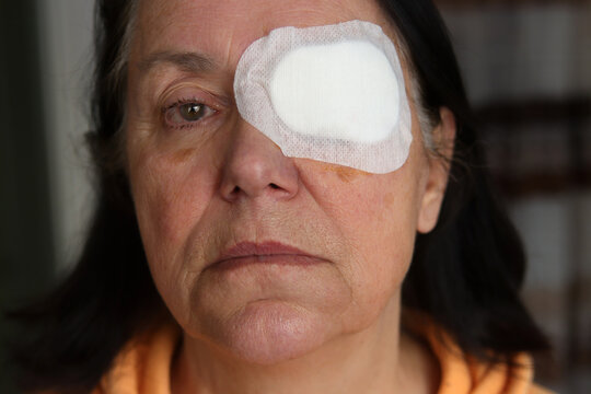 Operation am Auge