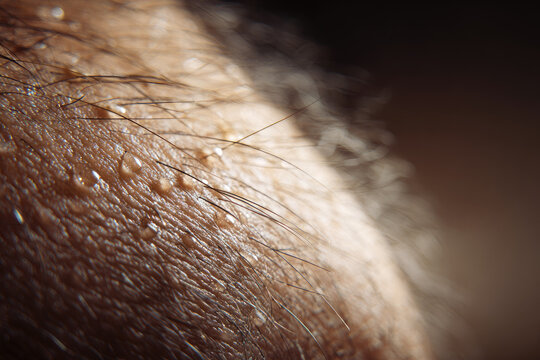 Close up of human skin with visible hair and sweat droplets showing texture and detail, sciatica nerve pain back concept, highlighting discomfort and sensitivity