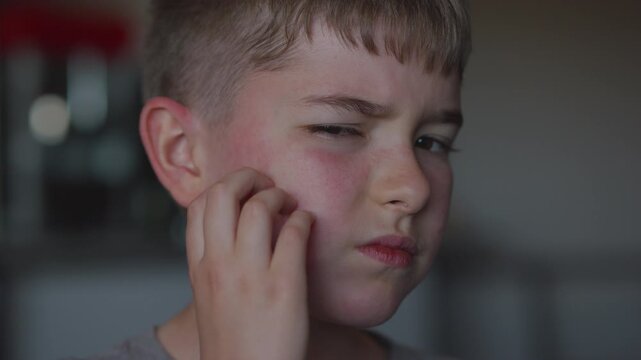 Boy Having Allergic Reaction on Skin to Food.	Boy Has Dry Red Skin and Scratching Her Face. Child Scratches Atopic Skin. Dermatitis, Diathesis, Allergy on Child Body and Face. Irritation and Pruritus.