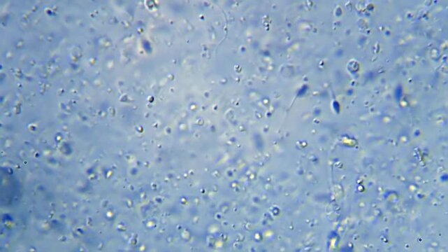 Energetic movement of a large number of sperm in the semen fluid under microscope on white background. Extreme closeup