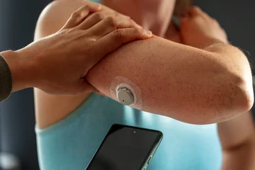 Diabetic young woman with glucose sensor and mobile phone measuring blood sugar level at home © Maksims