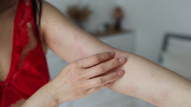 Young asian woman itching and scratching on arm from allergic itchy dry skin eczema dermatitis insect bites