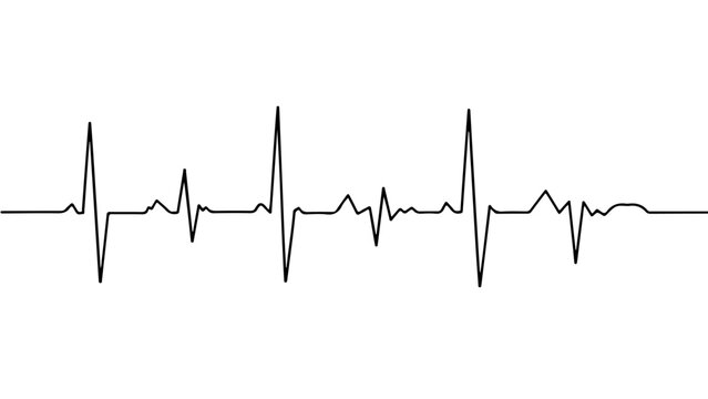 Graphical representation of a heartbeat pattern on an electrocardiogram strip