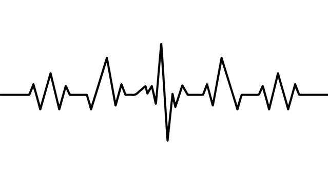 Graphic representation of an electrocardiogram showing heart rhythm patterns