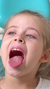 Close-up of little girl opening her mouth wide to the doctor to show her throat. Child is sitting with wide open mouth, with a tongue stuck out, clear view on the uvula and the soft palate