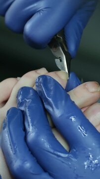 The podologist treats the toenails and cuticles on the patient's feet. High quality 4k footage