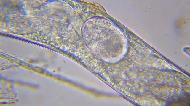 Nematode with internal eggs under 100x bright field microscopy panoramic view. 4K scientific microscopy footage.