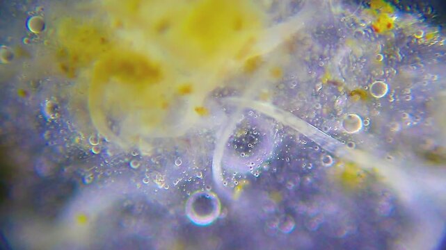 Cluster of nematodes intertwined under 100x dark field microscopy. 4K scientific microscopy footage.