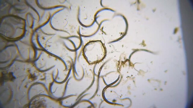 Large number of nematodes moving rapidly in panoramic view under 40x bright field microscopy. 4K scientific microscopy footage.