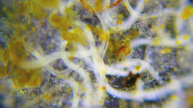 Cluster of nematodes intertwined under 100x dark field microscopy. 4K scientific microscopy footage.