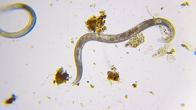 Large nematode with internal eggs under 100x bright field microscopy panoramic view. 4K scientific microscopy footage.