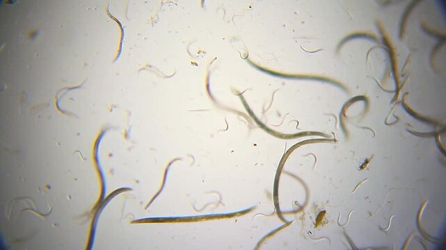 Large number of nematodes undulating in a water droplet under 40x bright field microscopy. 4K scientific microscopy footage.