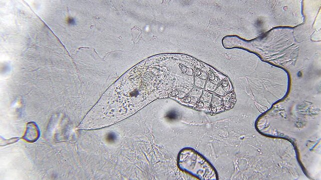 Demodex brevis mite immobile under 400x bright field microscopy. 4K scientific microscopy footage.