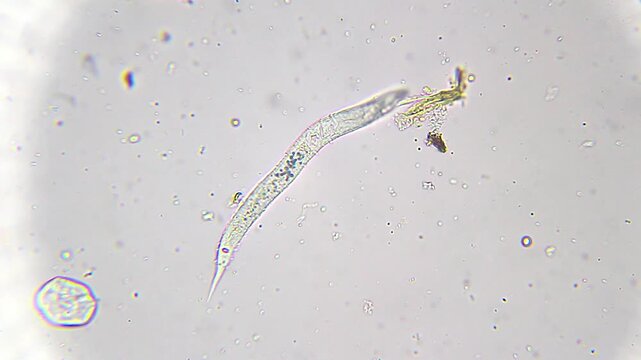 Slow moving nematode in water drop under 100x magnification bright field microscopy. 4K scientific microscopy footage.