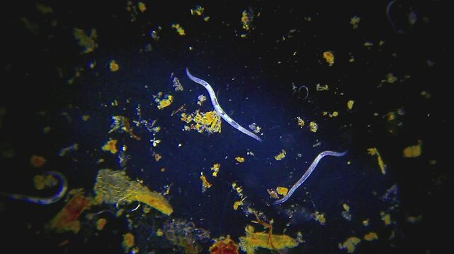 Slow moving nematodes in water drop under 40x magnification dark field microscopy. 4K scientific microscopy footage.