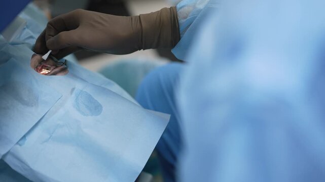 A surgeon performs a delicate ophthalmology procedure. Close up shot of a gloved hand using surgical tools on a patient's eye during cataract removal or laser correction surgery in a clinic