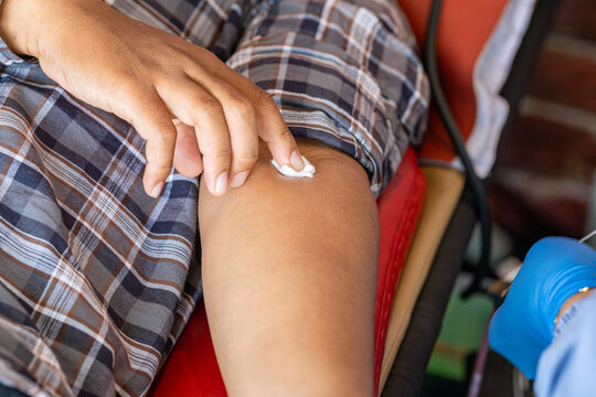 Donor pressing cotton on arm after blood donation, highlighting post procedure care and recovery in healthcare setting