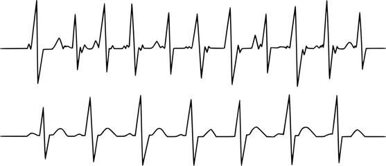 Obraz premium Rows of black electrocardiogram heart rhythm lines a white background medical
