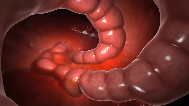 Human Large Intestine Internal View.