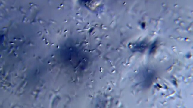Energetic movement of a large number of sperm in the semen fluid under microscope on white background. Extreme closeup