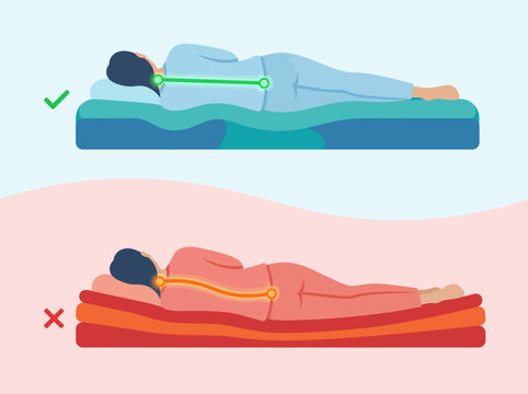 This informative image contrasts the correct sleeping posture with an incorrect one, emphasizing the significance of proper spinal alignment for promoting back health and comfort.