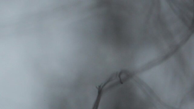 Threads lint seen with an optical microscope