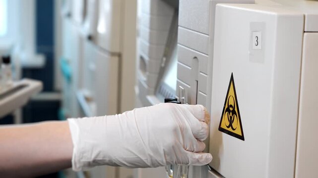 Close up of lab technician scanning biological samples using automated diagnostic system in clinical laboratory environment.