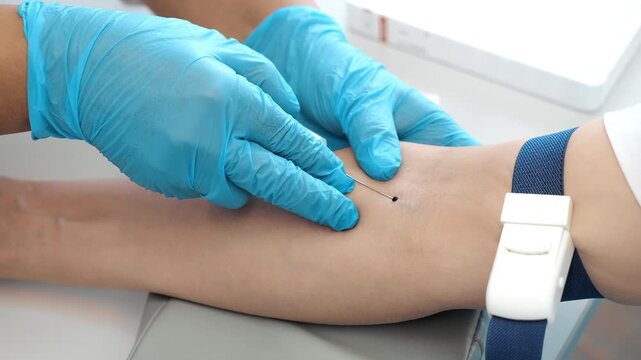 Medical worker collecting blood sample from patient arm using needle in clinical laboratory environment for diagnostics and healthcare testing.
