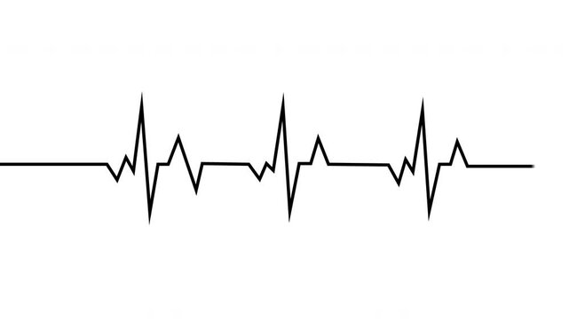 Heartbeat Ecg Monitor Pulse Line Loop Animation Black On White Background