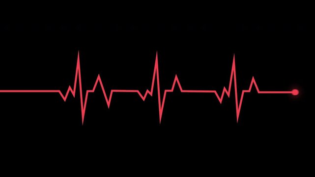 Heartbeat Ecg Monitor Pulse Line Animation Isolated On Black