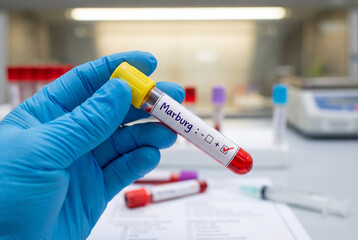 Naklejka premium Gloved hand holding a marburg virus blood sample tube in a laboratory