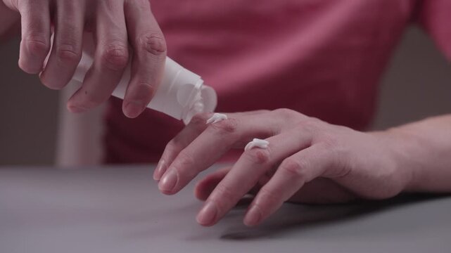 Closeup of man applying moisturizing healing cream from tube on knuckles and fingers for eczema or dermatitis, massaging dry skin for hydration, medical skin care treatment. Shooting in slow motion.