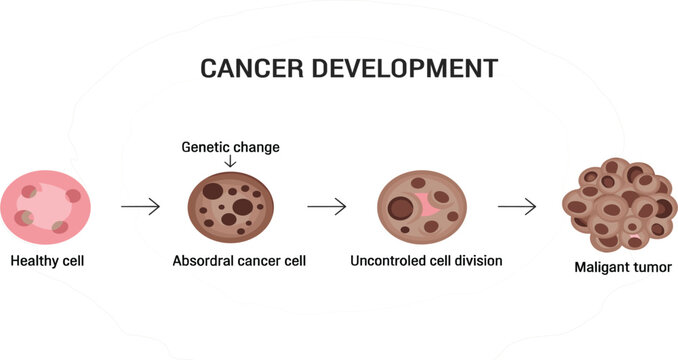 Cancer development stages medical infographic showing healthy cell genetic mutation uncontrolled cell division and malignant tumor formation biology education vector