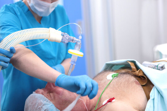 An elderly man is injected with an endotracheal tube. Tracheal intubation. Anesthesia before surgery. Modern medicine. Preparation for the operation.
