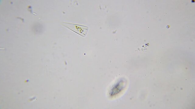 Ciliate with extended radial cilia and diatom drifting under 1000x magnification brightfield microscopy with immersion oil. 4K scientific microscopy footage.