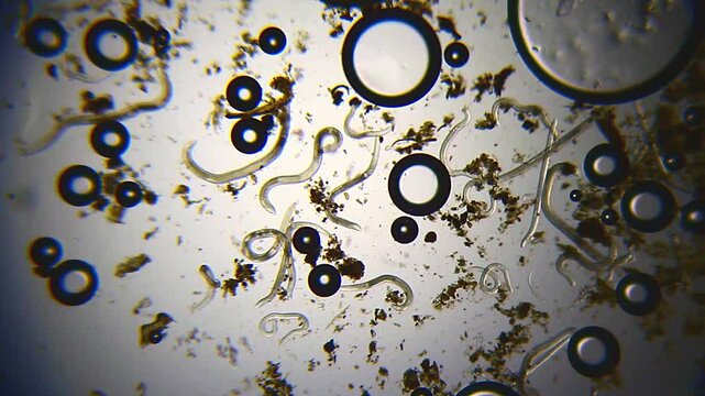 Nematodes in liquid medium with gas bubbles under 40x magnification brightfield microscopy. 4K scientific microscopy footage.