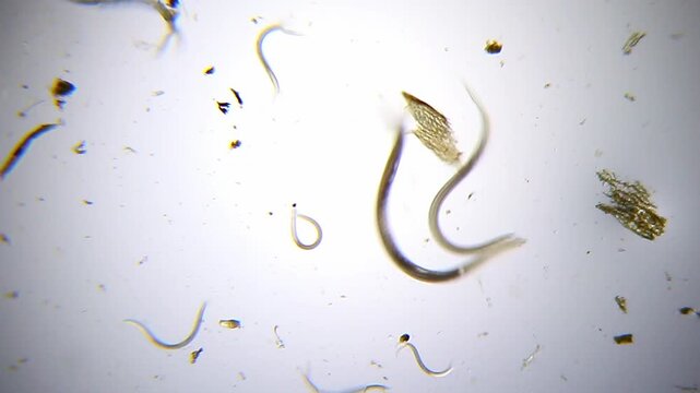Multiple nematodes moving in wave-like motion panoramic view under 400x magnification brightfield microscopy. 4K scientific microscopy footage.