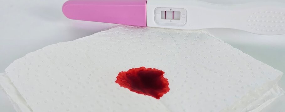 Pregnancy test on a napkin with a blood stain indicating possible complications