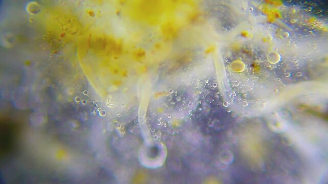 Multiple nematodes moving densely among detritus under 100x magnification darkfield microscopy. 4K scientific microscopy footage.