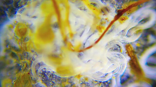 Multiple nematodes moving densely among detritus under 100x magnification darkfield microscopy. 4K scientific microscopy footage.