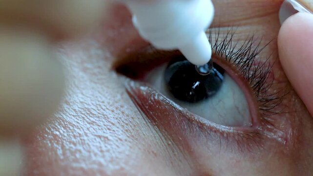 Person Using Medicated Dropper for Dry Eye Relief and Ocular Health Isolated on Macro Detail for Healthcare and Medical Visualization