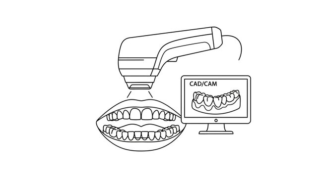 Dental CAD/CAM Scanner and Digital Impression of Teeth