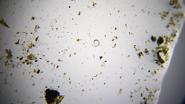 Nematode moving among organic detritus under 40x magnification brightfield microscopy. 4K scientific microscopy footage.