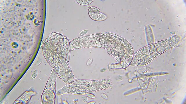Bdelloid rotifers feeding with visible internal structures among protozoa under 400x magnification brightfield microscopy. 4K scientific microscopy footage.