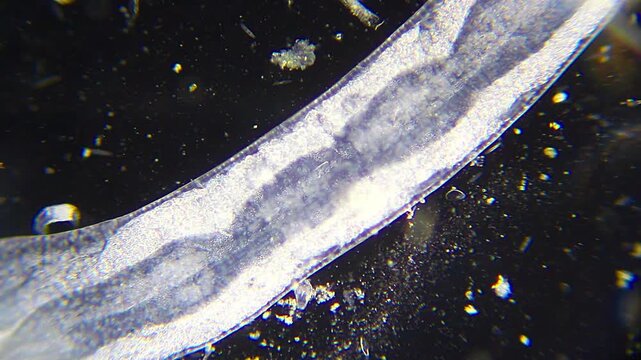 Annelid with visible digestive tract movement under 100x magnification darkfield microscopy, rotifer passing in background. 4K scientific microscopy footage.