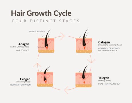 Hair Growth Cycle - 4 Distinct Stages - Stock Illustration