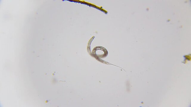 Nematode coiled in loop shape in free space under 100x magnification brightfield microscopy. 4K scientific microscopy footage.