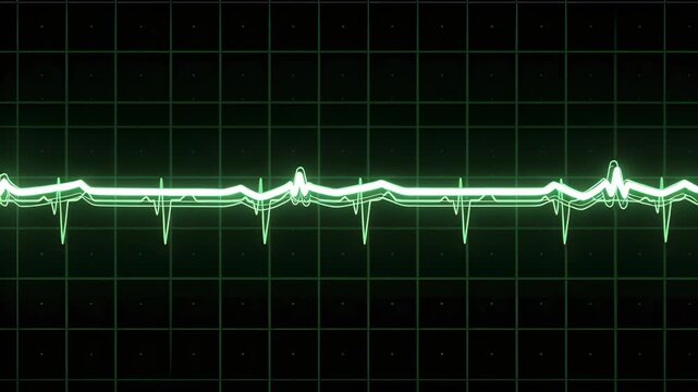 On QRS peak entering left, double ECG trace moving across grid, thin trace mirroring for monitoring